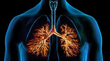 احذر ..إلتهاب الشعب الهوائية 