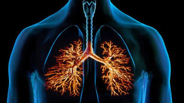 احذر ..إلتهاب الشعب الهوائية 