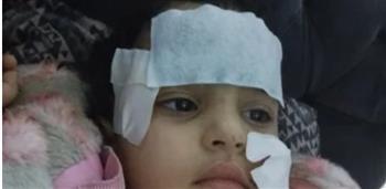 النيابة العامة تحقق في حادث هجوم أسد على طفلة داخل السيرك القومي بالعجوزه