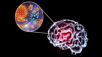 انتبه تلك العوامل تزيد من التهاب الدماغ