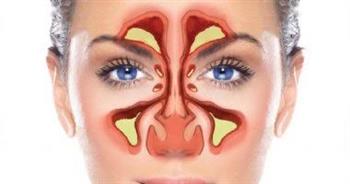 4 نصائح للوقاية من التهاب الجيوب الأنفية