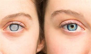 انتبه ..عوامل قد تؤدي للإصابة بالجلوكوما