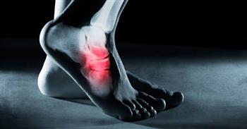 ألم مشط القدم.. الأسباب والأعراض