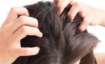 للنساء.. علامات تكشف حاجة فروة رأسك للراحة من صبغات الشعر
