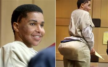 طبيب تجميل مزيف يحقن مريضاته بالأسمنت والغراء