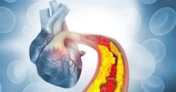 احذر .. تأثير الكوليسترول على صحة القلب