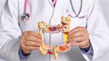 القولون التقرحي.. ورحلة حمل آمنة بهذه الشروط