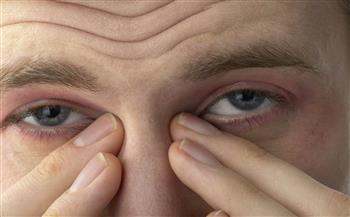انتبه ..دموع العين قد تكون مؤشر لانسداد القناة الدمعية