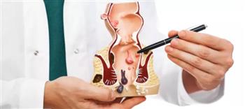 أعراض الإصابة بالشرخ الشرجي