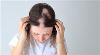 هل تعالج حلاقة الشعر الثعلبة؟.. تعرفي على الحقائق