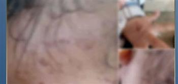  الأمن يكشف ملابسات ادعاء تعذيب طفل بالشرقية