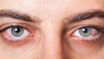 انتبه...تأثير ارتفاع ضغط الدم على العين