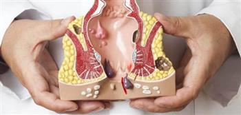 4  نصائح للوقاية من البواسير