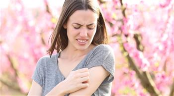 أعراض وطرق الوقاية من حساسية الربيع