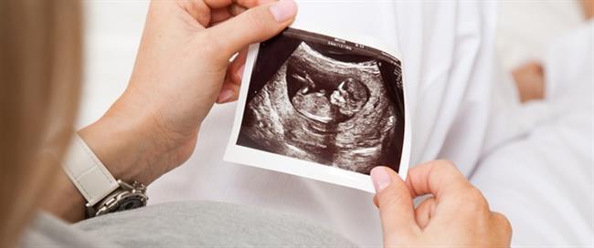 أسباب تعكر ماء الجنين