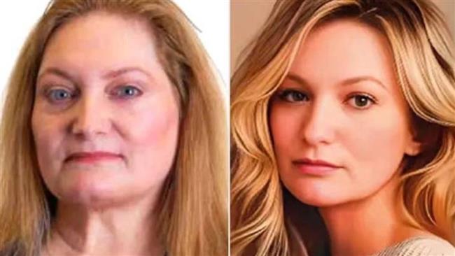 هولندية تفقد عضويتها في حزب محلي بسبب صورة غيّرت ملامحها