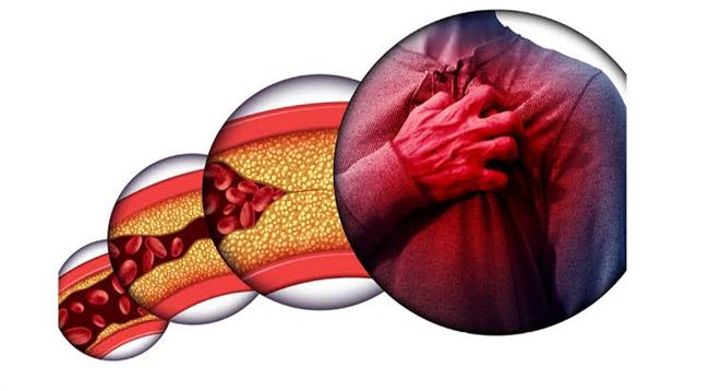 علامات ارتفاع الدهون الثلاثية وتأثيرها على أعضاء الجسم