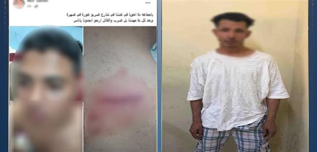 الداخلية تكشف ملابسات الاعتداء على شاب بالجيزة وضبط المتهم