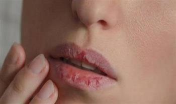 لو ظهرت على فمك هذه التغيرات.. فأنتِ تعانين من نقص فيتامين ب12
