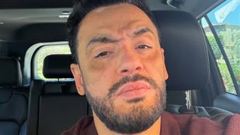 رامي جمال يلفت الأنظار بإطلالة حزينة داخل سيارته