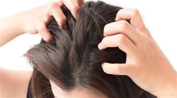 4 أسباب وراء الشعور بالحكة في فروة الرأس