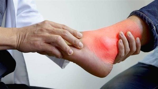 انتبه..أعراض ارتفاع الأملاح في الجسم