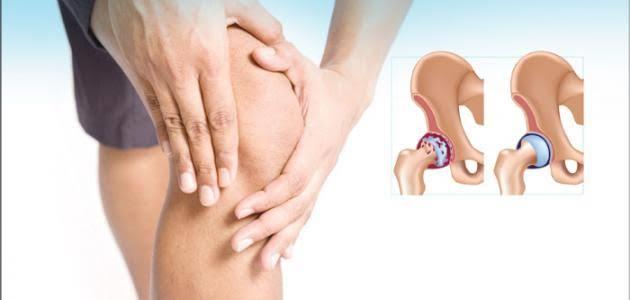 عادات السيئة تضر العظام والمفاصل..ابتعد عنها