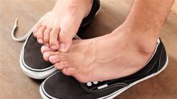 تينيا أصابع القدم.. أسبابها وطرق الوقاية