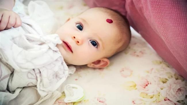 ماذا تعرف عن وحمة الفراولة؟ 