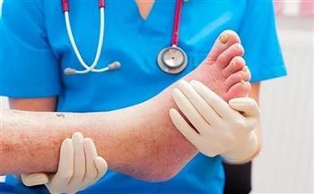 أعراض التهاب النسيج الخلوي البكتيري وطرق الوقاية منه
