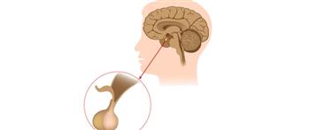 انتبه.. لاضطرابات الغدة النخامية