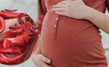 أعراض أنيميا الحمل وطرق الوقاية