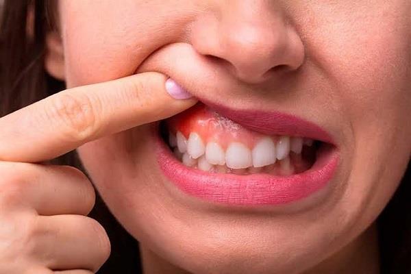 الصحة توضح أهم أسباب ألم الأسنان واللثة
