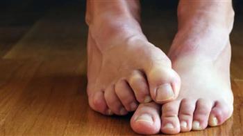 متلازمة تململ الساقين..الأسباب والأعراض