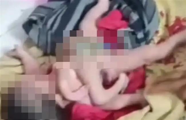 صدمة في الهند.. ولادة نادرة لطفل بـ "8 أطراف"