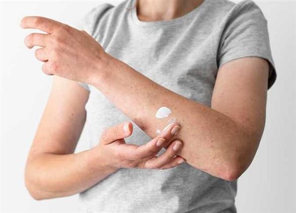 بعد العودة من المصيف.. علامات جلدية تستدعي زيارة الطبيب
