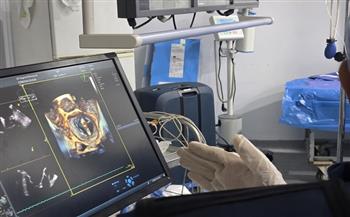 جامعة سوهاج تنجح في إجراء أول حالة لإصلاح الصمام الميترالي بالقسطرة باستخدام «Mitral Clip»