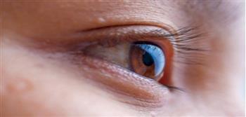 التهاب الغدة الدمعية..الأسباب والأعراض