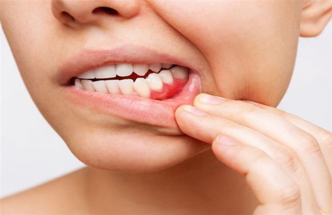 أسباب التهاب عظم الفك 