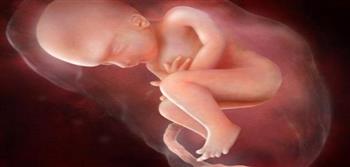 حقيقة تعكر ماء الجنين أثناء الحمل