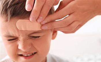 ليست كل الكدمات عابرة.. علامات على جسم طفلك تستدعي الانتباه