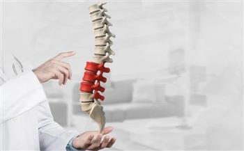 أسباب وأعراض ضيق القناة العصبية القطنية