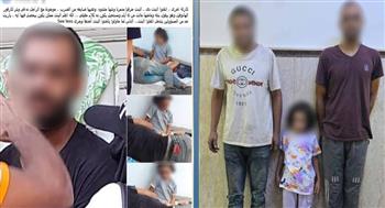 بعد ظهورها مصابة في الوجه.. الداخلية تكشف ملابسات استغلال طفلة في التسول بالإسكندرية